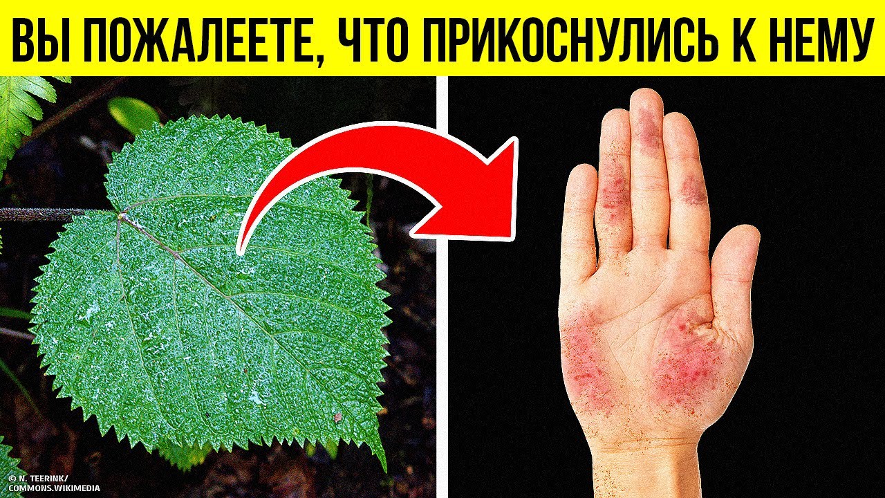Коварное растение, ожог которого не заживает годами