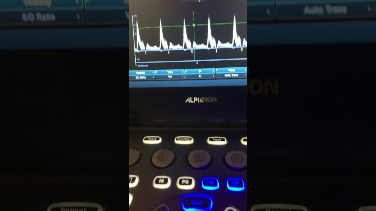 Alpinion Ecube i7 - how to use labeled measurements for Doppler