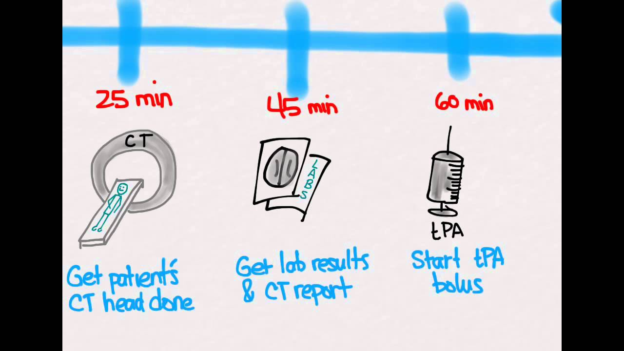 Ischemic Stroke 04: Treatment with tPA