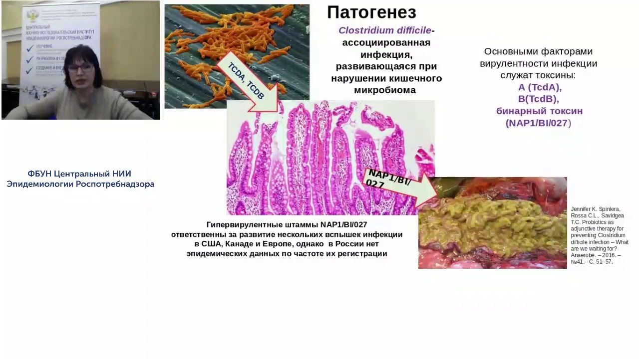 Современные аспекты атибиотикоасоциированного колита у взрослых