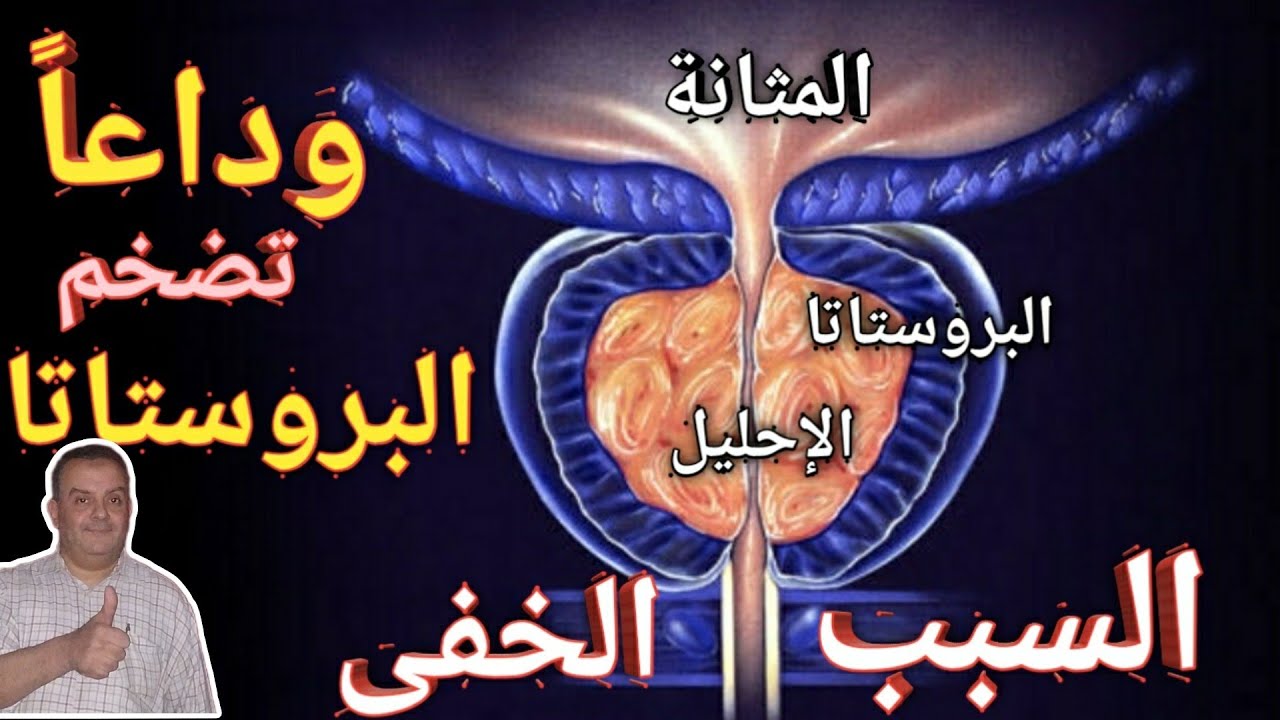 هذا السر لو عرفته لن تصاب بتضخم البروستاتا ضعف الانتصاب والسرعة طول حياتك| الحق نفسك علاج ووقاية