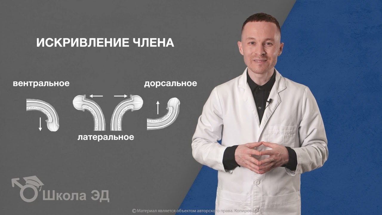 Урок 28 Искривление члена (болезнь Пейрони) и потенция