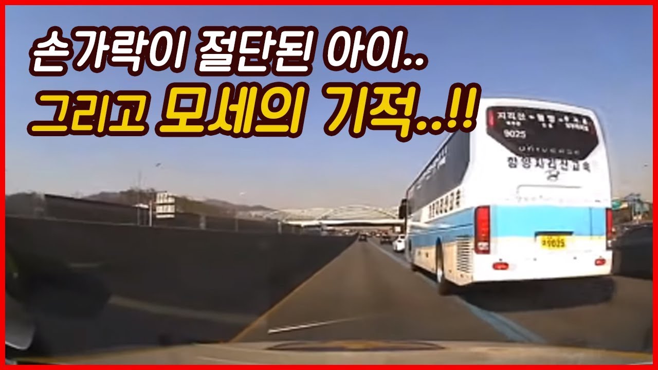 손가락이 잘린 아이, 그리고 또 하나의 모세의 기적....