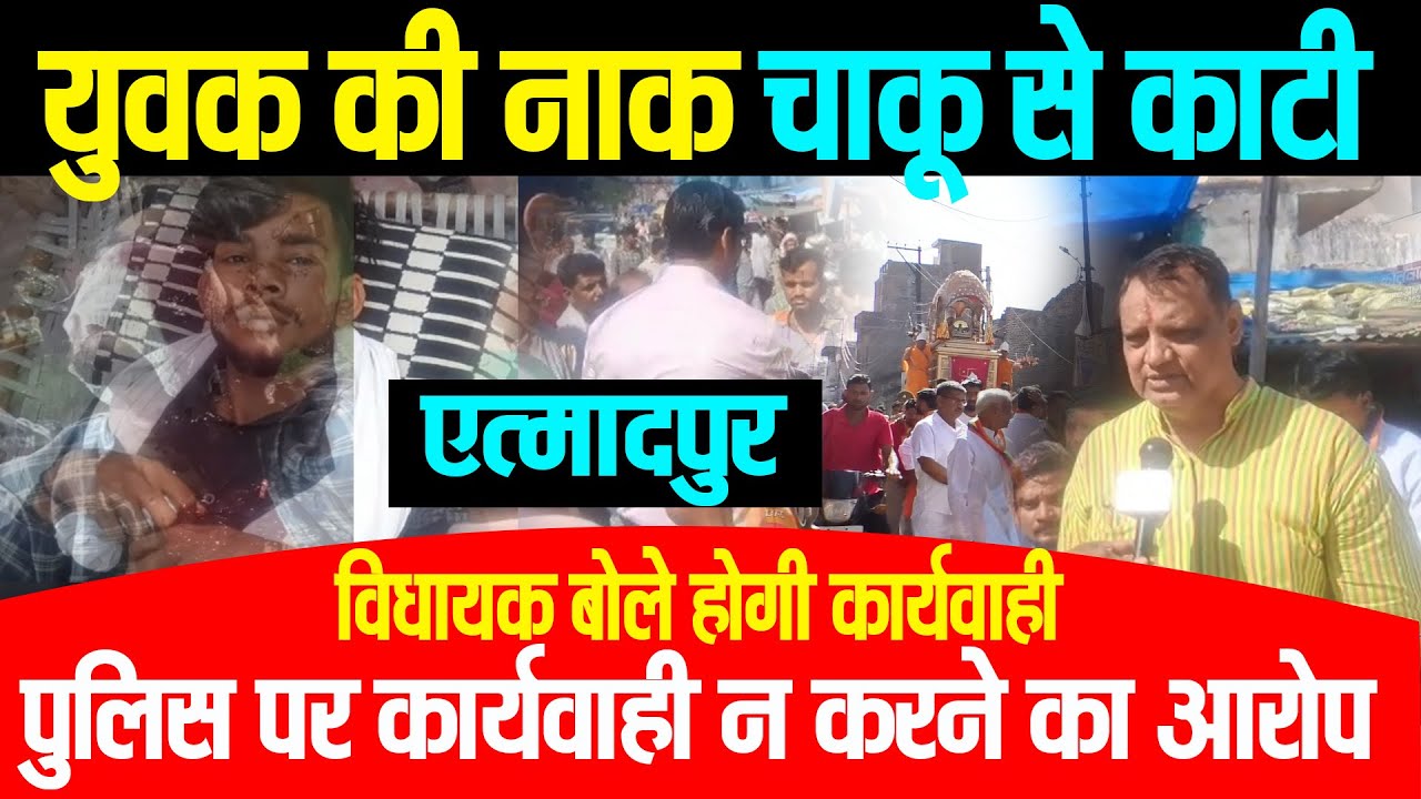एत्मादपुर: में युवक ने किया चाकू से हमला,हमले में युवक की नाक में पर आये हैं 40 टाँके,विधायक बोले हो