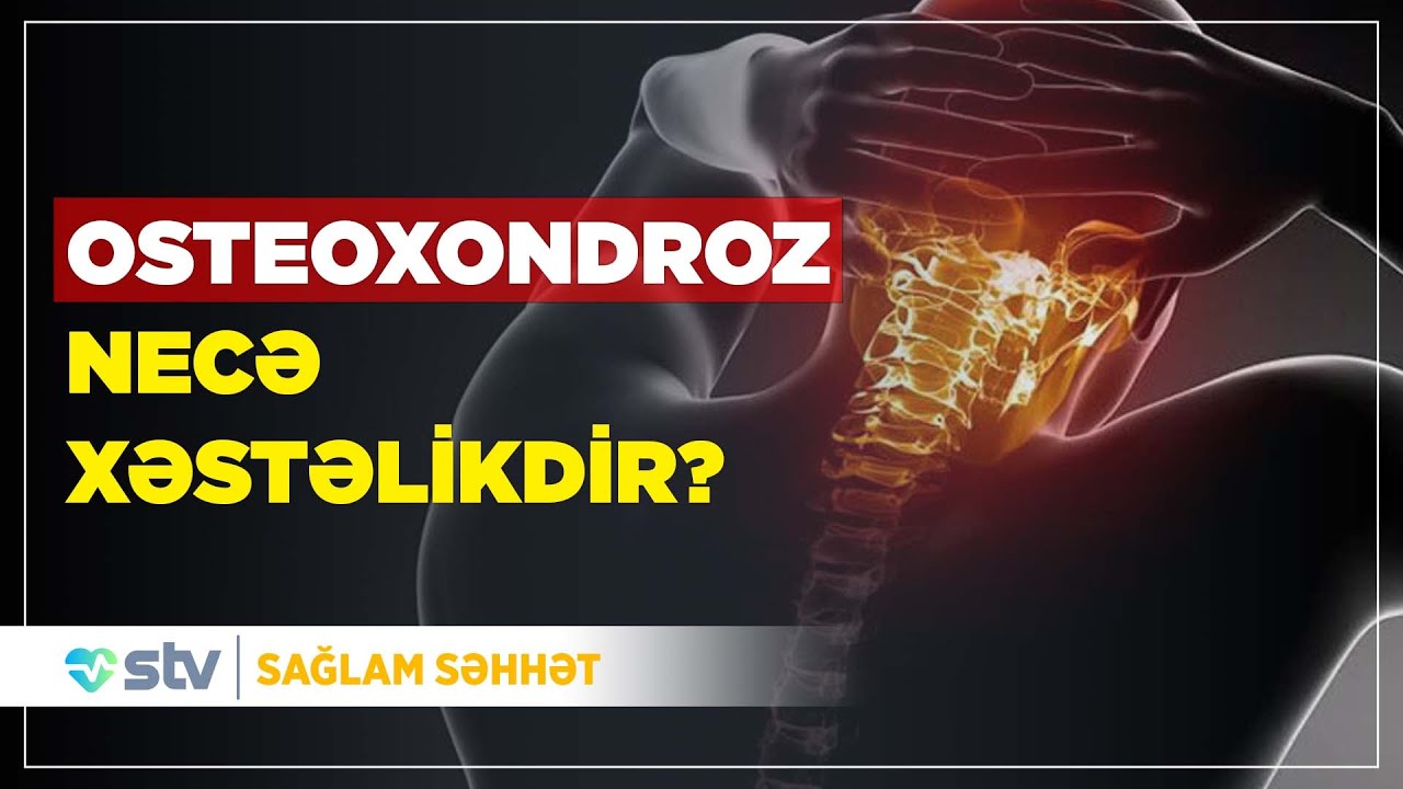 Osteoxondrozun nevroloji fəsadları