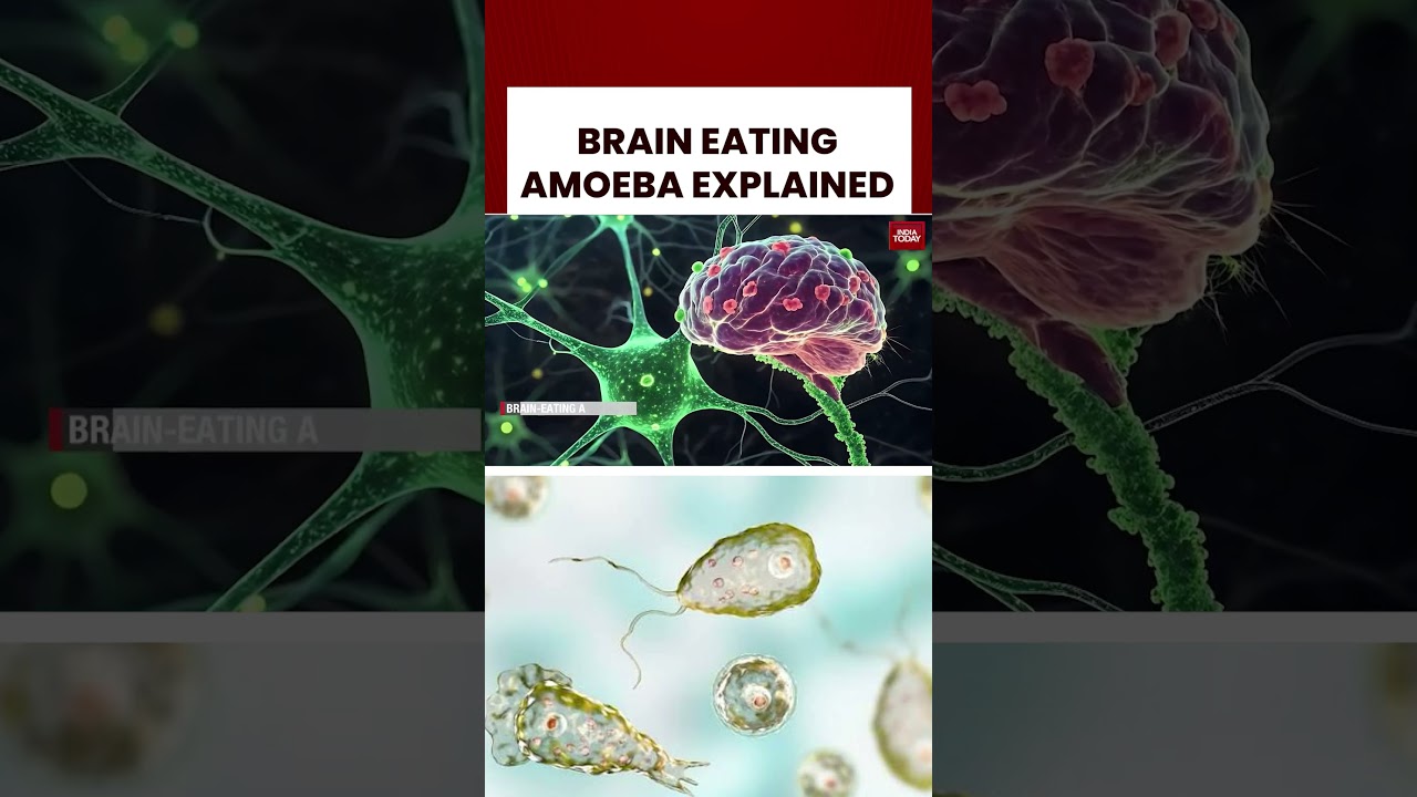 Kerala on High Alert as Brain-Eating Amoeba Crisis: Death Toll Rises to 18 | India Today News