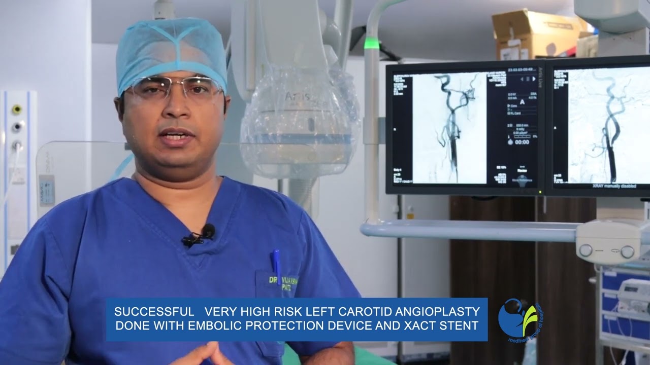 Dr. Vijay Sinh Patil takes us through Carotid Angioplasty.