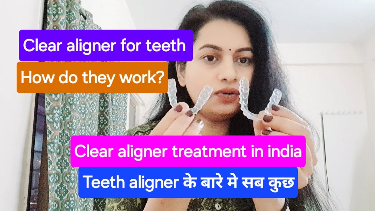 Clear aligner for teeth 💁‍♀️| Aligner के बारे मे सब कुछ | Invisalign | Transparent aligner 😬 #smile