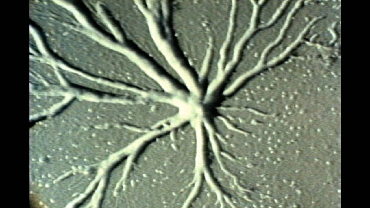 73. Development of Cellular Slime Molds, Dictyostelium discoideum, D. Purpureum & D. Minutum