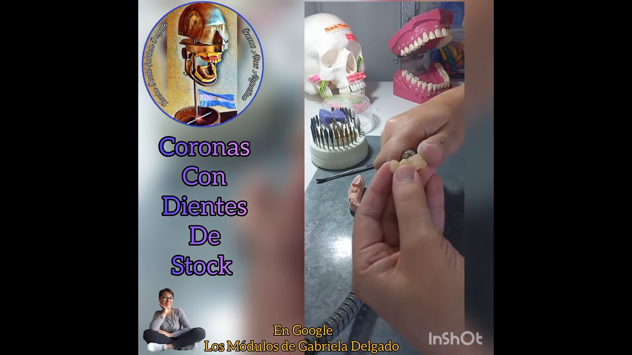 Coronas con dientes de stock