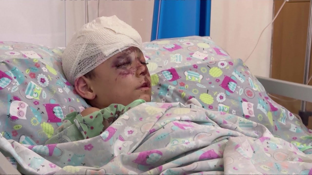 أطفال أصيبوا بالقصف الإسرائيلي على جنوب لبنان يتلقون العلاج في مركز طبي بمدينة صيدا