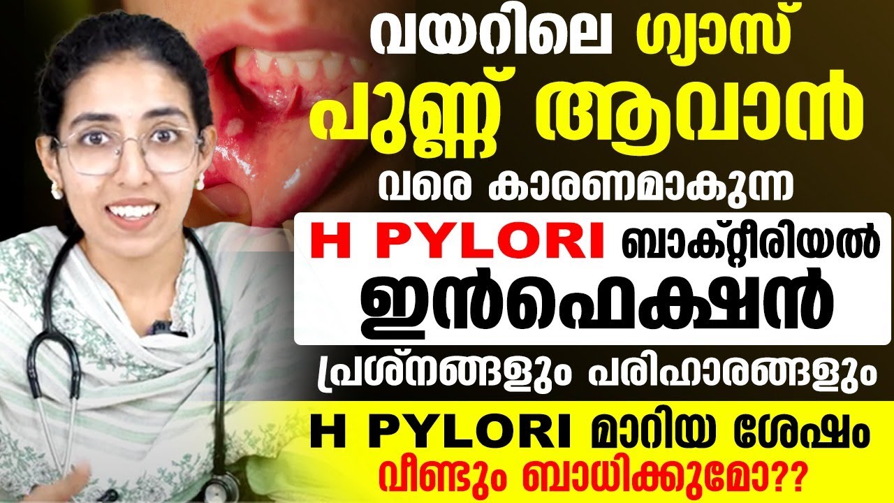 H PYLORI ബാക്റ്റീരിയൽ ഇൻഫെക്‌ഷൻ പ്രശ്നങ്ങളും പരിഹാരങ്ങളും | വയറിലെ ഗ്യാസ് പുണ്ണ് ആയി മാറുന്നു