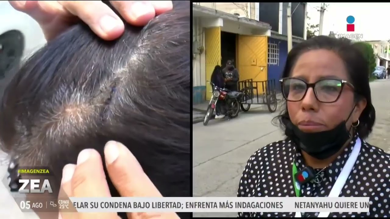 Beatriz deja su hogar luego de ser víctima de asalto en Chimalhuacán | Zea