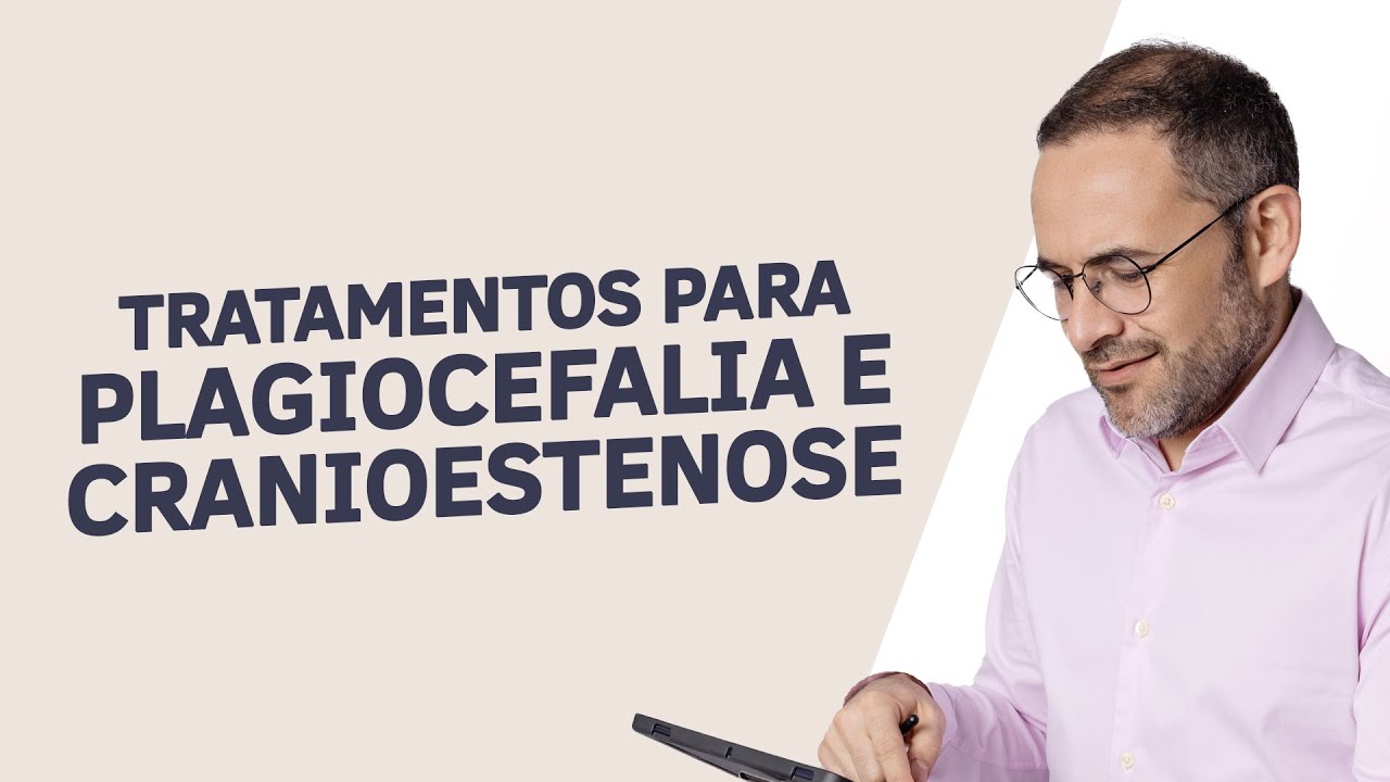 Tratamentos para Plagiocefalia e Cranioestenose: Evite Sequelas da Deformidade Craniana