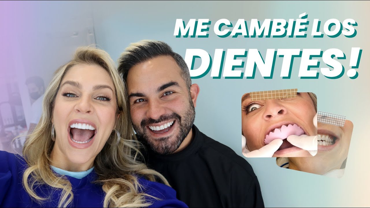 ME CAMBIÉ LA SONRISA! MIS DISEÑO DE SONRISA CON DOCTOR MAARTEN !-Daniela Di Giacomo