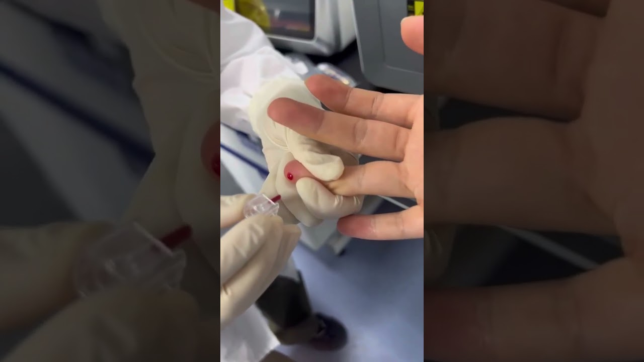 30ul capillary from fingertip blood EHBT 50