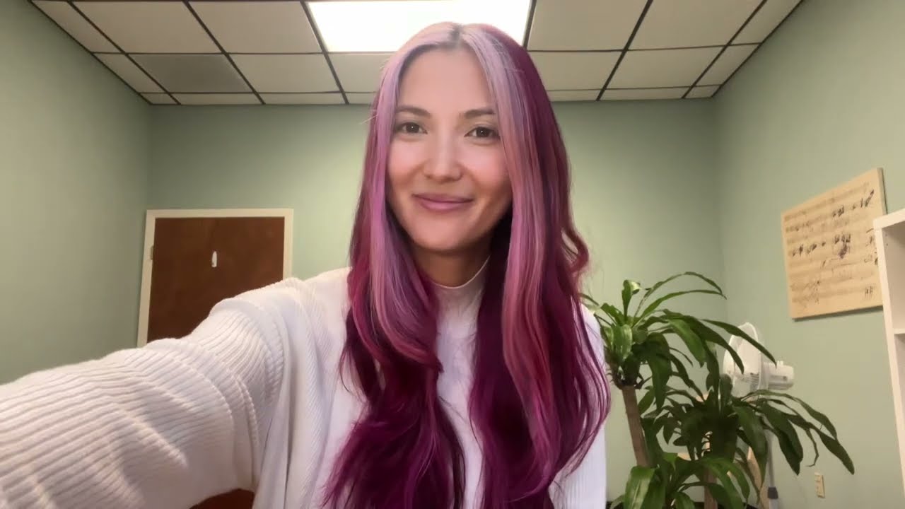 3 Years Post Nuss Procedure for Pectus Excavatum