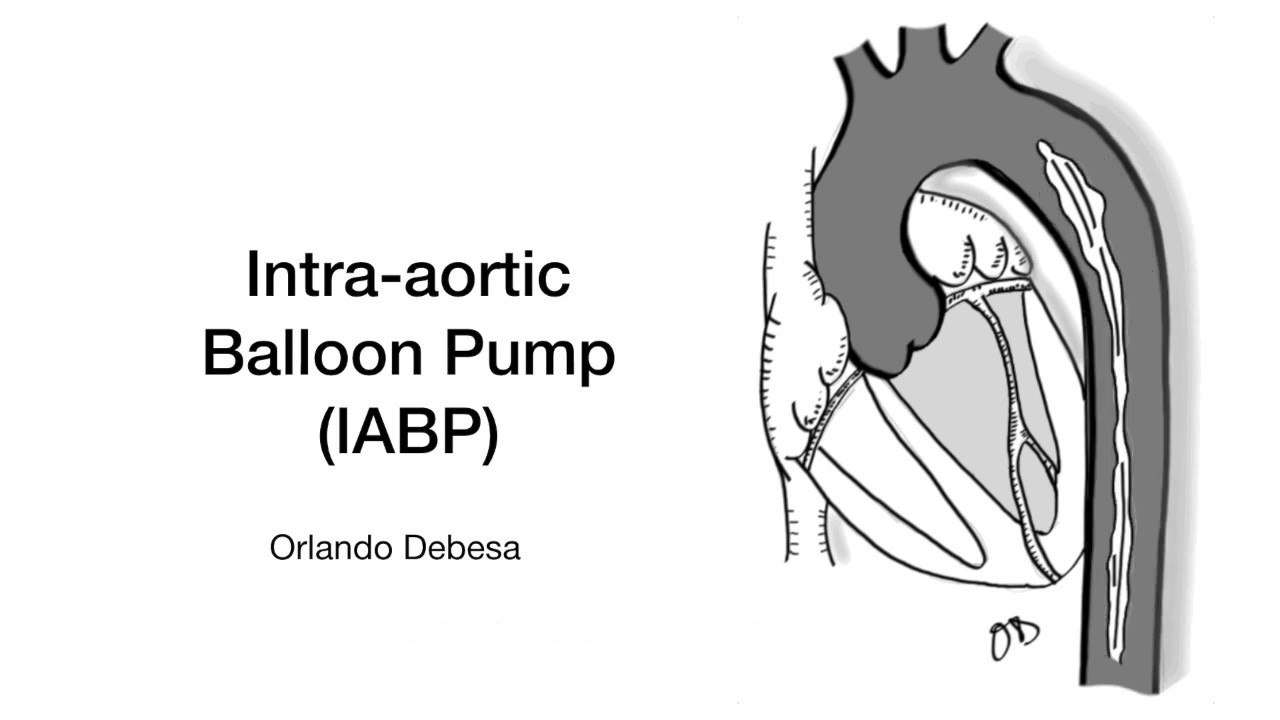 Intra-Aortic Balloon Pump
