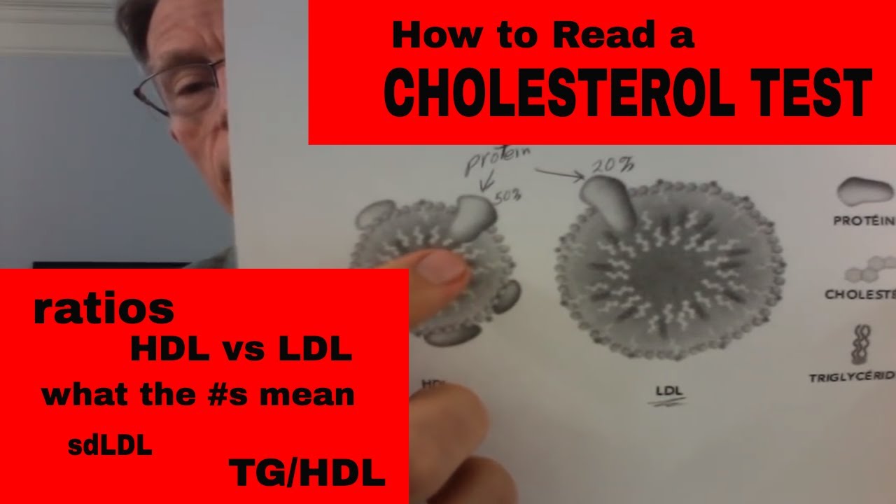 How to Read a Cholesterol Test (LDL, HDL, IDL, VLDL)