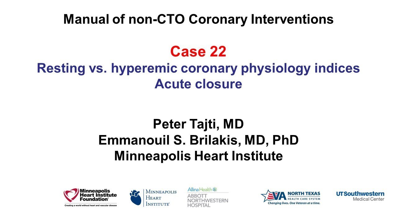 Case 22: PCI Manual - Acute closure