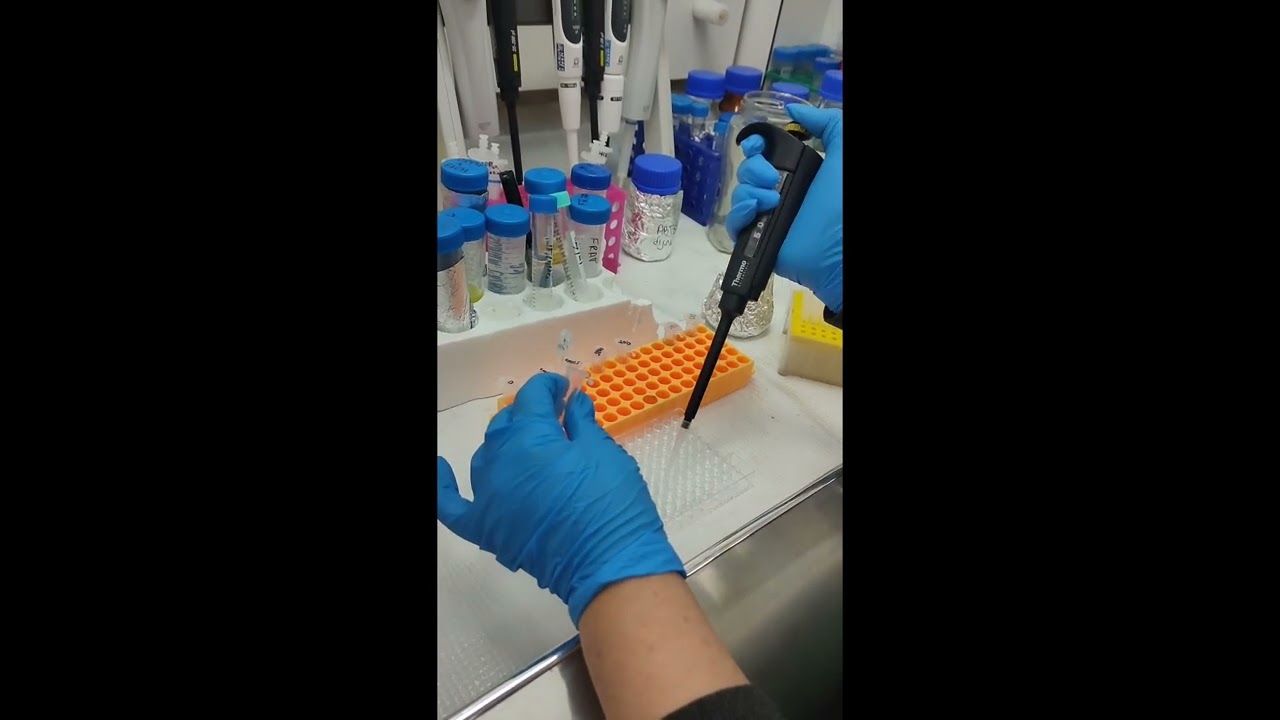 ABTS Antioxidant analysis