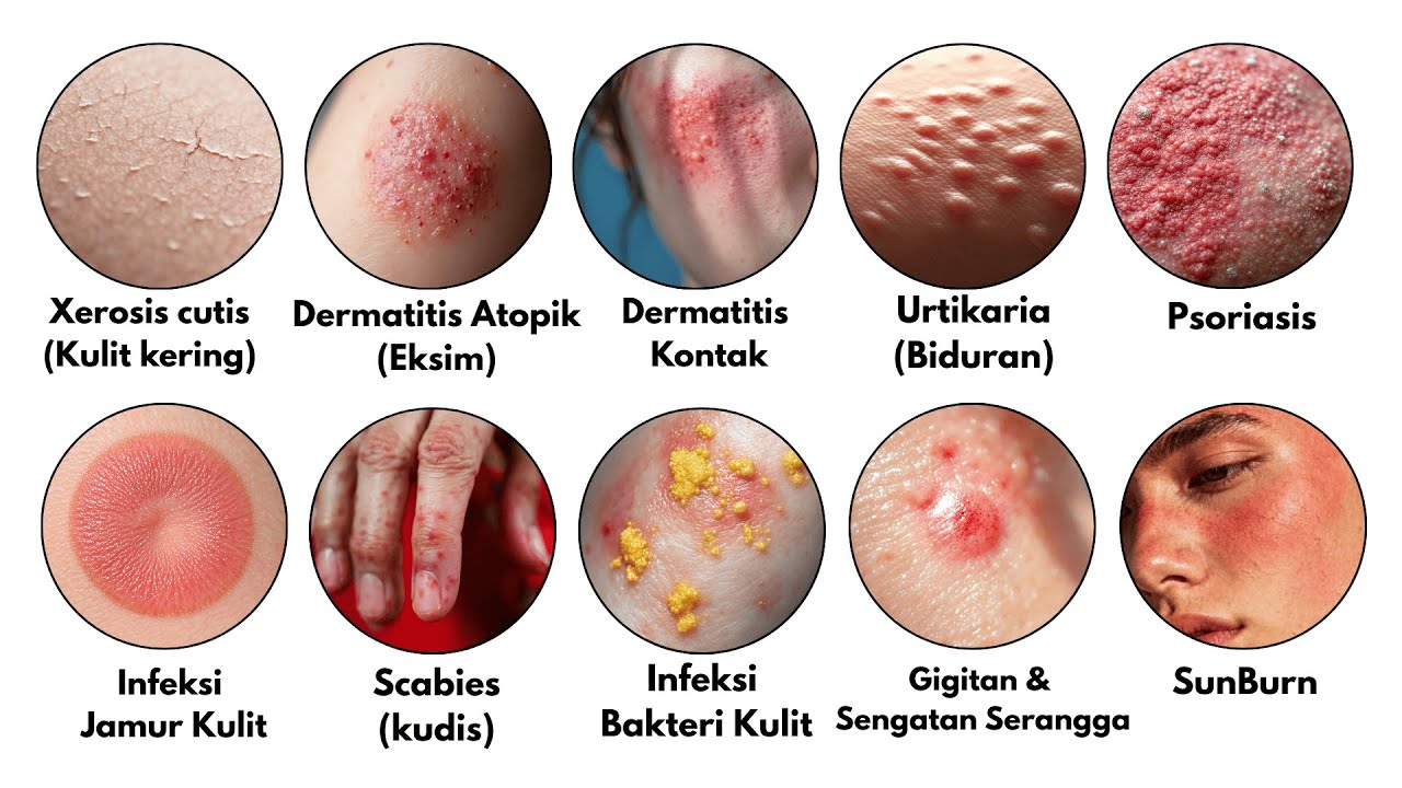 Semua Jenis Gatal Kulit yang Mungkin Bikin Kamu Merinding Dijelaskan dalam 9 Menit!
