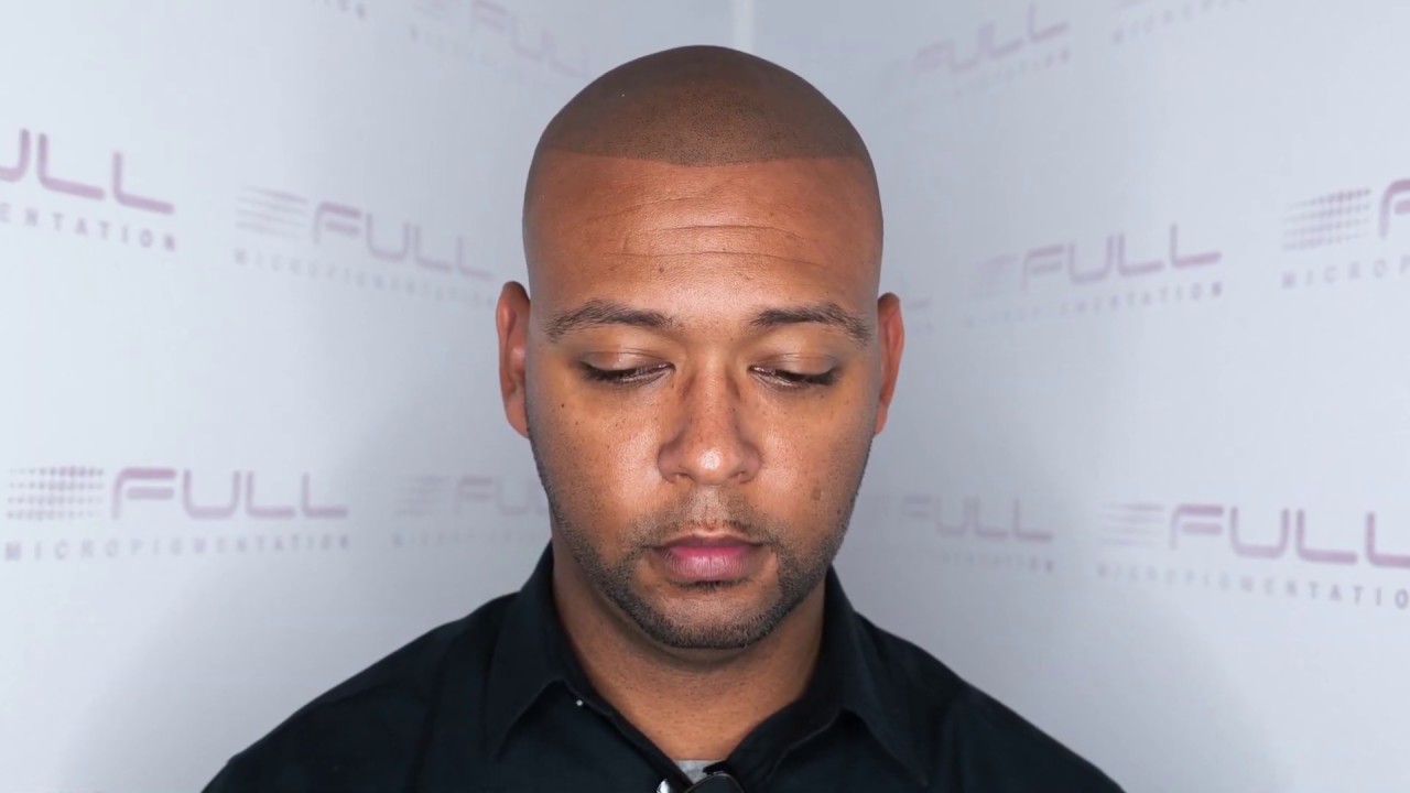 FULL Story of a Life Changing SMP Testimonial - FULL Micropigmentation - Las Vegas, NV