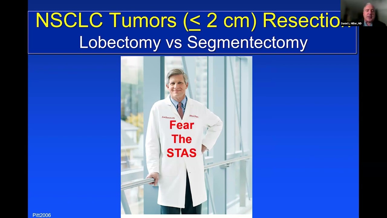 STS Webinar: Sublobar Resection Versus Lobectomy for Early-Stage Lung Cancer: A Debate