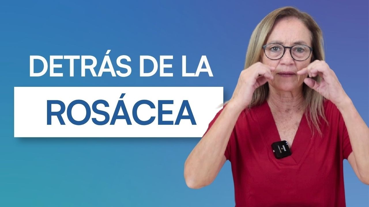 Rosácea: conflictos emocionales que afectan tu piel - Ángeles Wolder