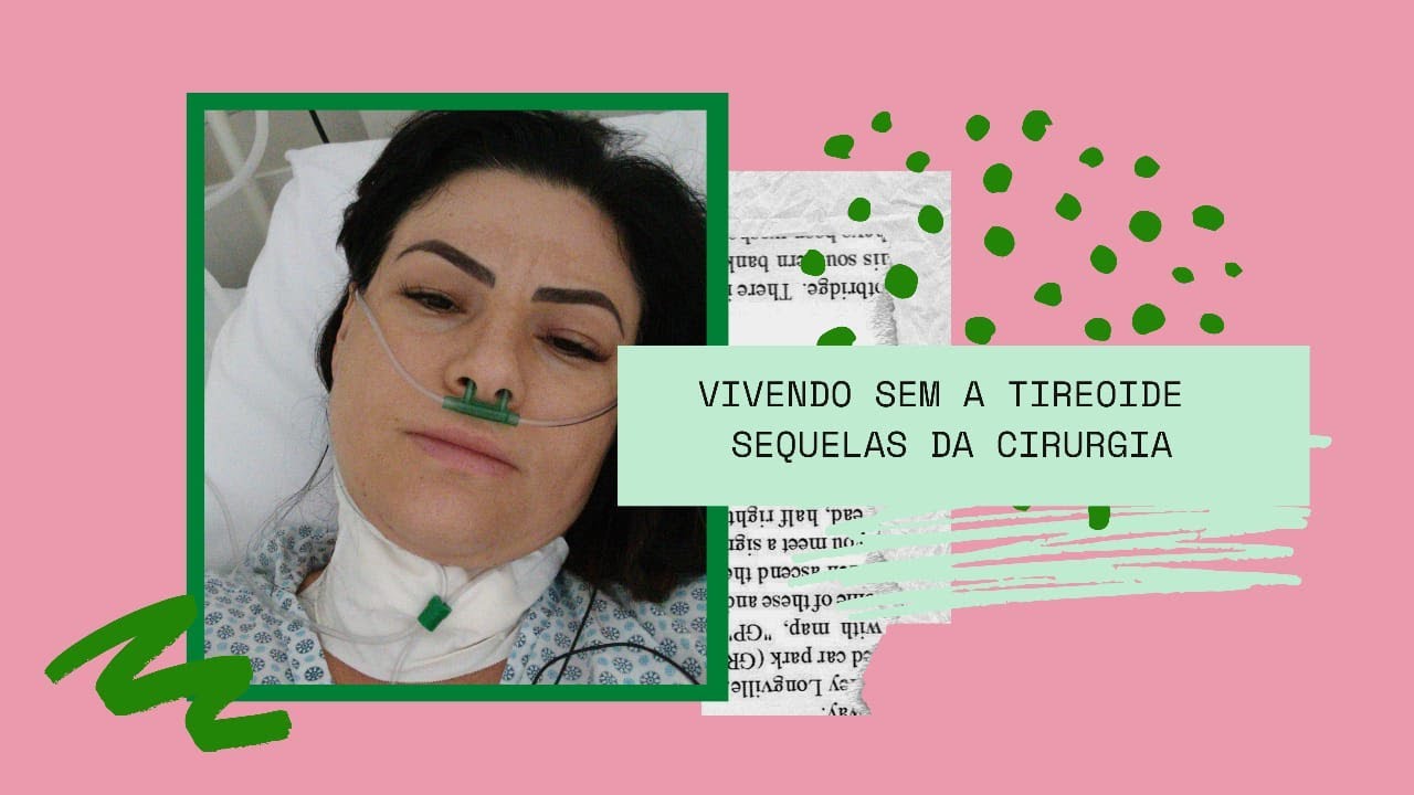 Vivendo sem a tireoide