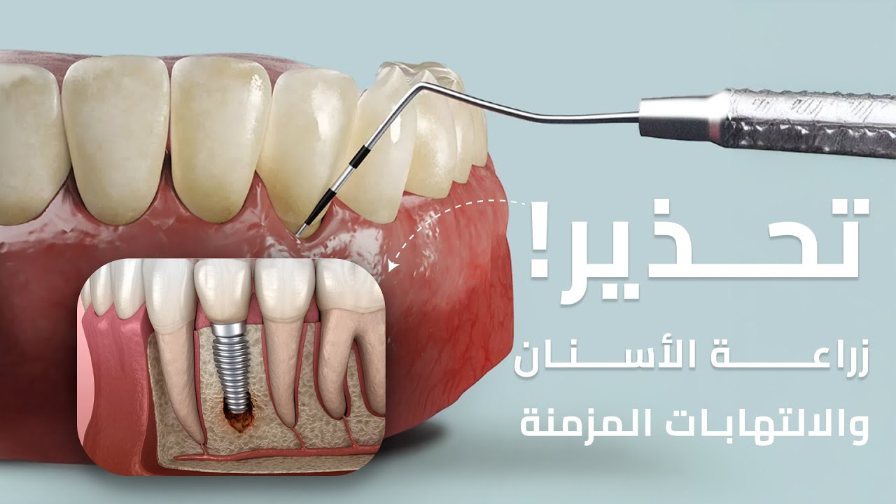 أسنانك كويسة؟ هذه أهم نصائح طبيب الأسنان عشان تظل قوية