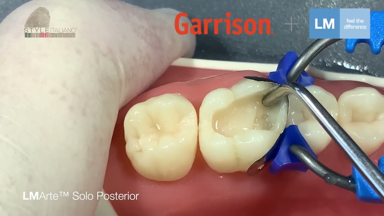 LM-Arte&trade; Solo instruments for your daily restorative cases