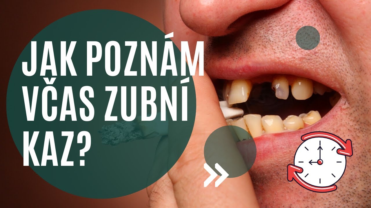 👀💥Jak poznat včas zubní kaz?! A kdy už je naopak pozdě..