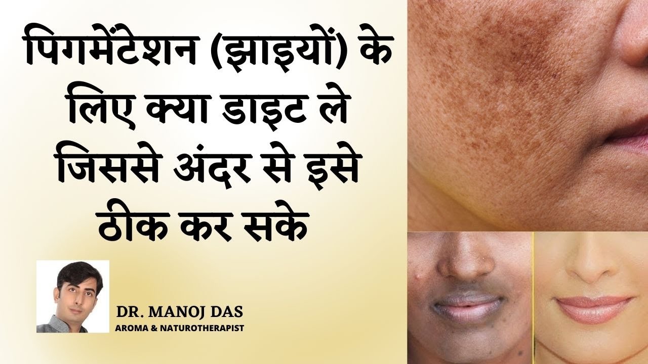 Diet to Reduce Skin Pigmentation I झाइयों को कम करने के लिए क्या खाये | GLOWING SKIN I DR. MANOJ DAS