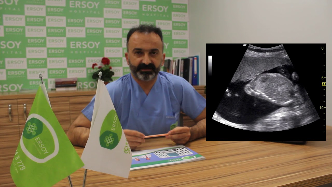 Ayrıntılı Ultrason Nedir, Ayrıntılı Ultrasonda Bebeğin Muayenesi Nasıl Olur?