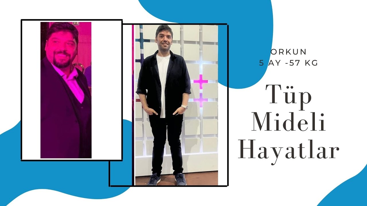 Op. Dr. Onur Kesler - Tekirdağ Obezite Cerrahisi #tüpmideameliyatı #çorlu