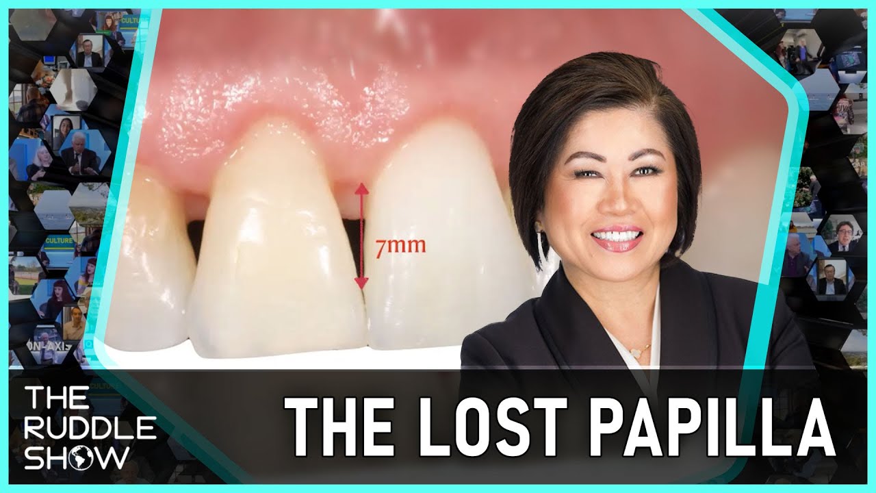 S12 E09 - The Restoration of the Lost Papilla: Special Guest Presentation by Dr. Jean Wu