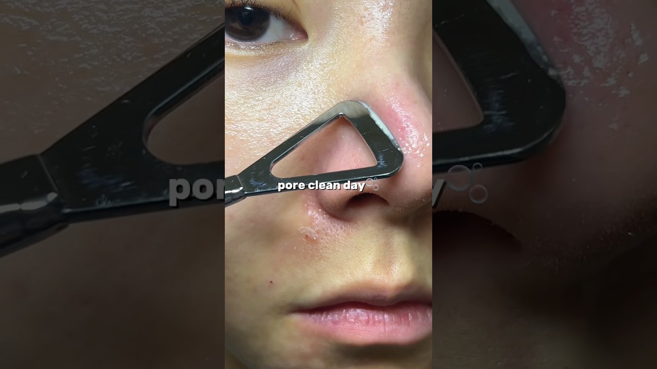 #blackheads #blackheadsremoval #beplain #skincare
