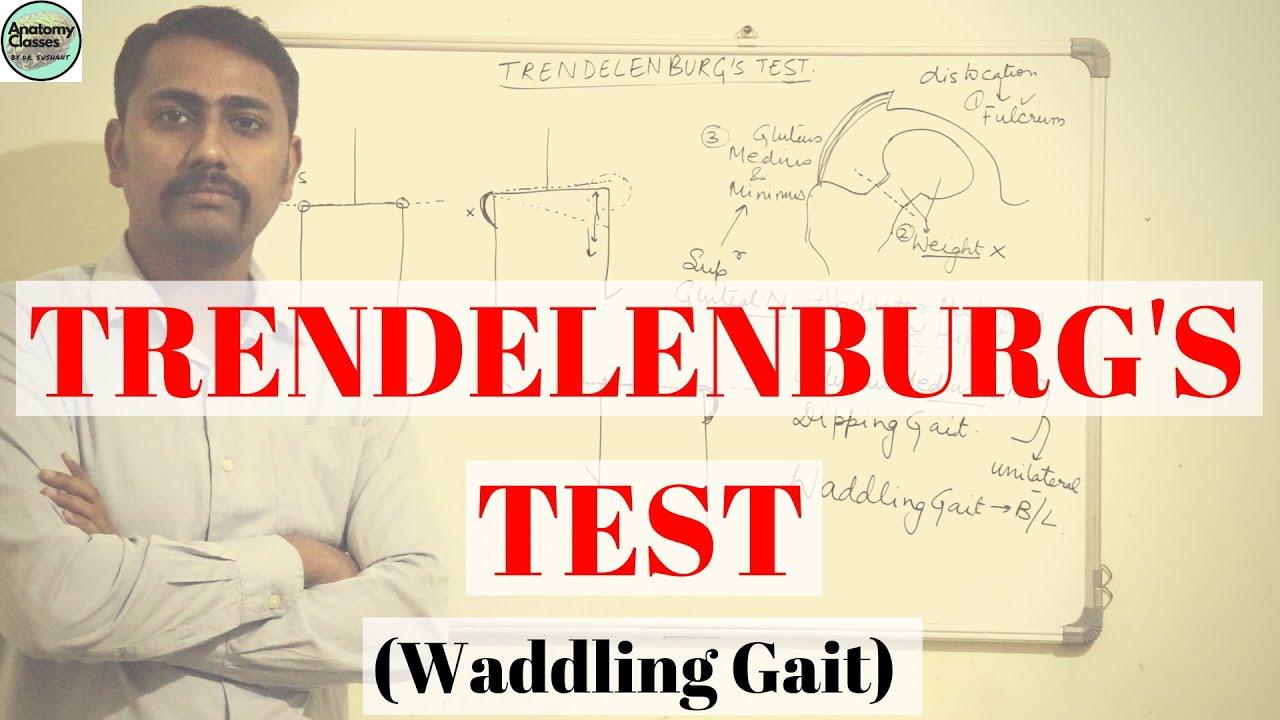 Trendelenburg's Test I Waddling Gait