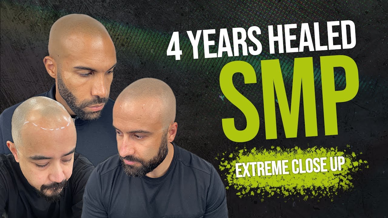 The Truth About Healed SMP Results