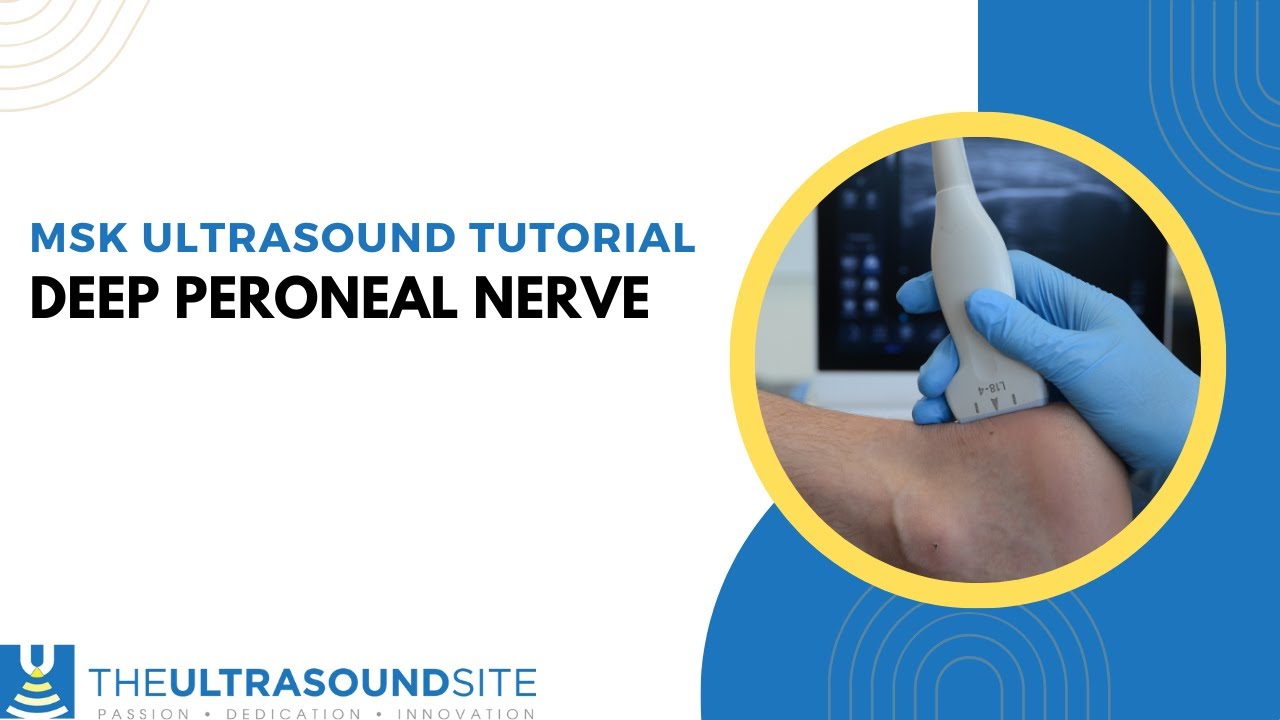 Deep peroneal nerve