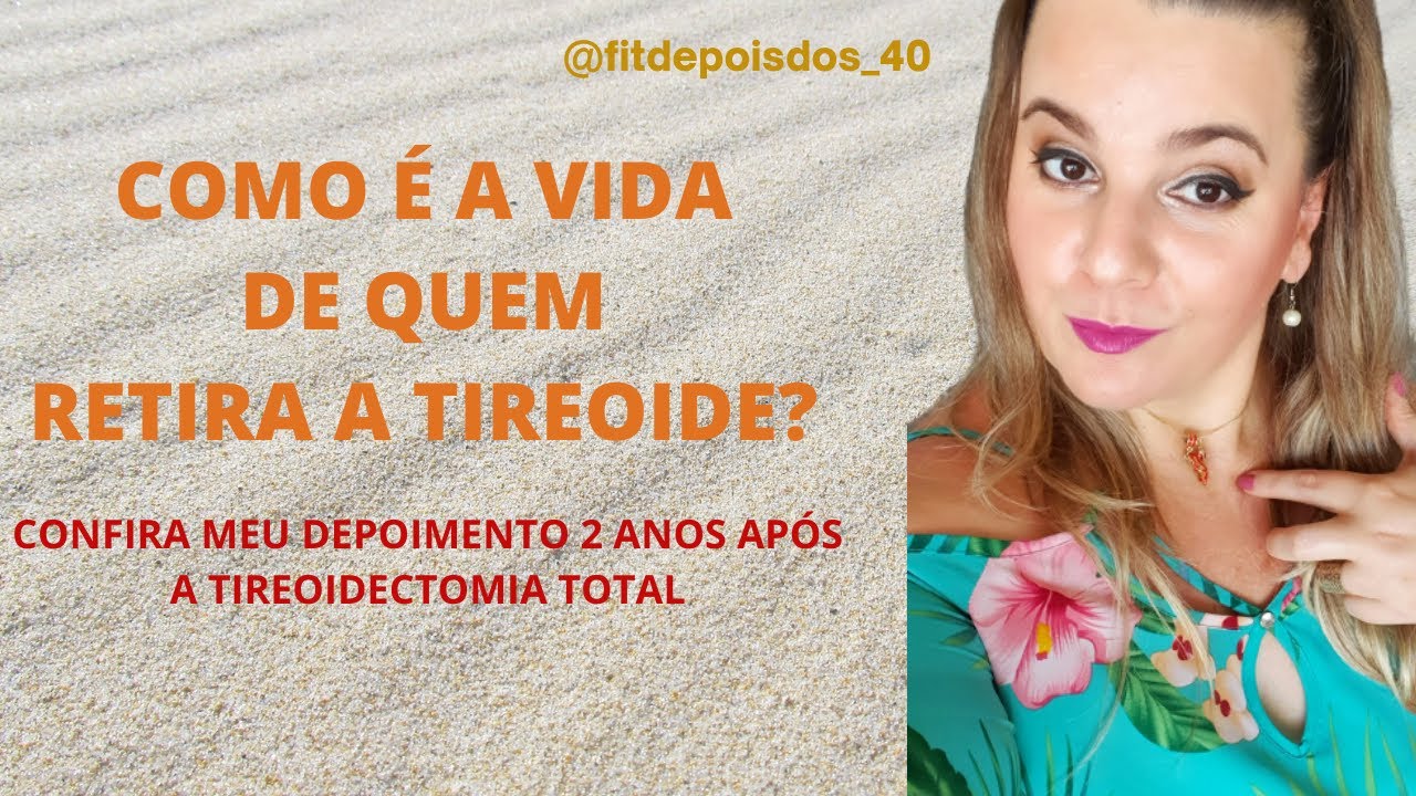 COMO &Eacute;  A VIDA DE QUEM RETIRA A TIREOIDE? ( Depoimento p&oacute;s cirurgia da tireoide)