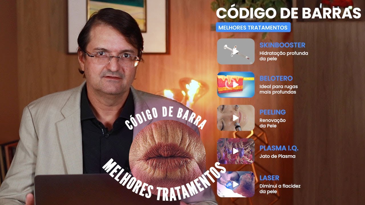 MELHOR Tratamento para rugas de código de barras na boca SEM CIRURGIA!