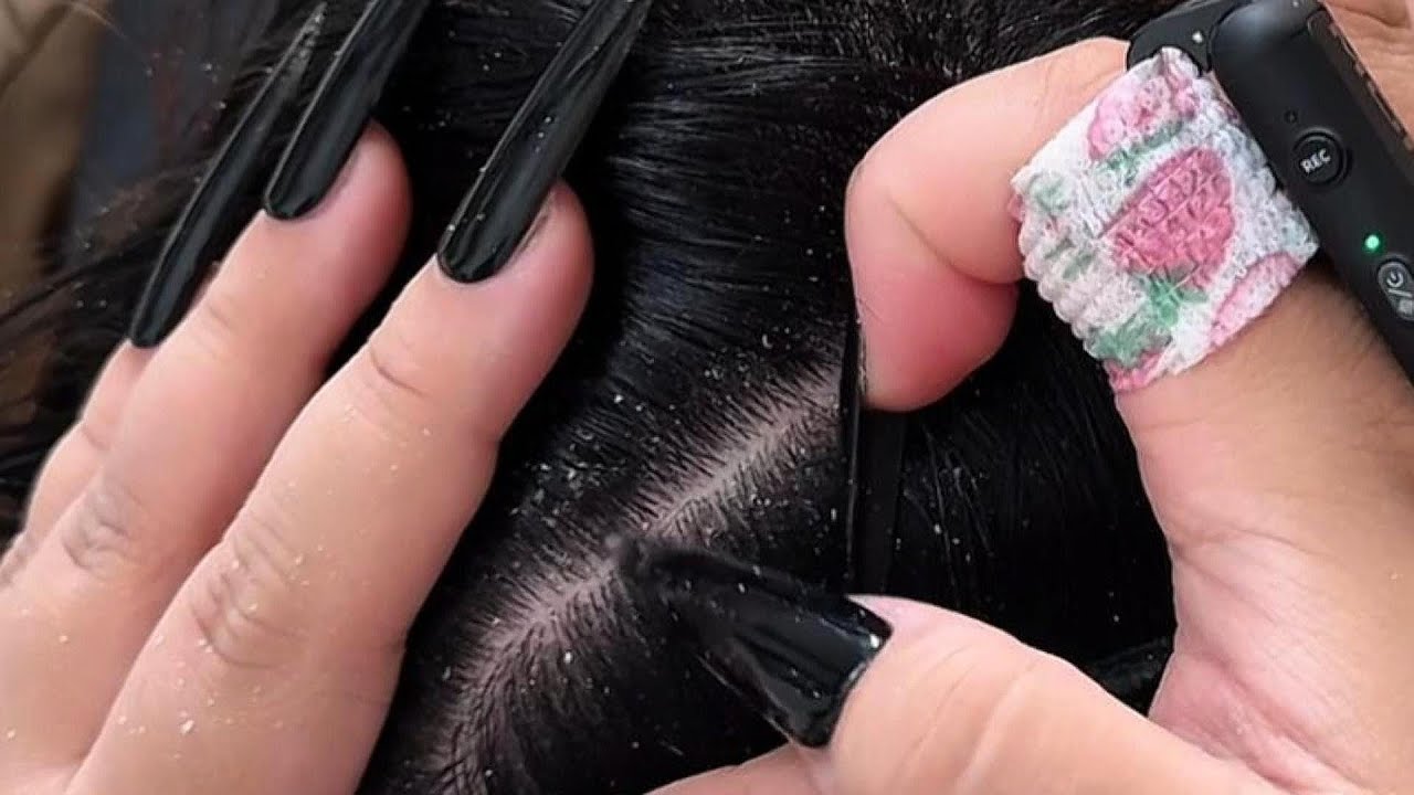 ASMR Scalp Scratching with Nails | Deep Dandruff Cleaning for Sleep