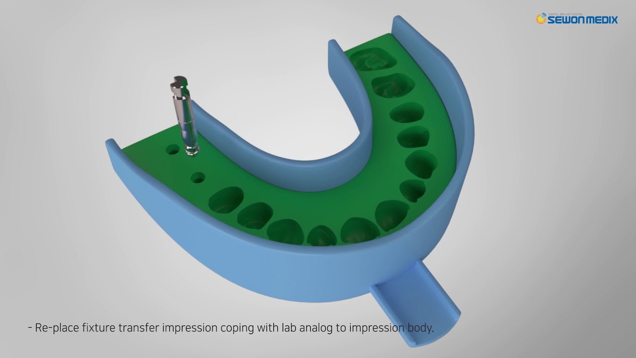 [SEWONMEDIX] CCM Casting Abutment
