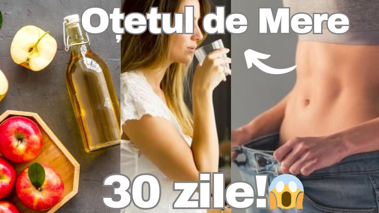 AM BĂUT OȚET de MERE pentru 30 zile😱Cât am slăbit  și ce rezultate am observat 😱