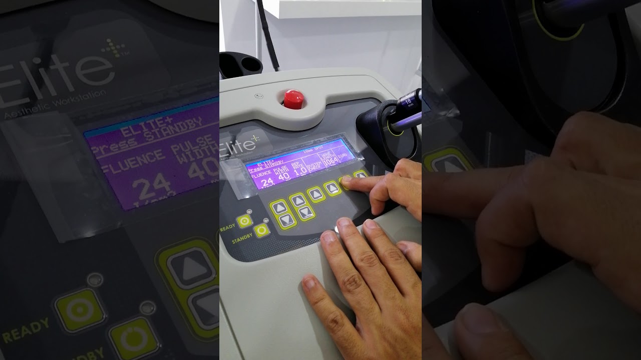 Cynosure Machine, laser hair removal (training)