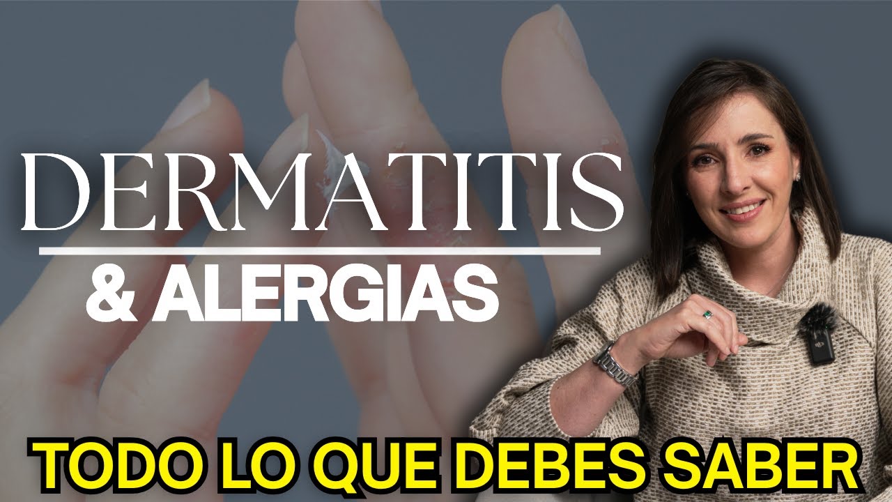 ¡Alerta! Todo lo que Nadie te Dice sobre Dermatitis y Alergias @drapilarochoa - Dermatologa