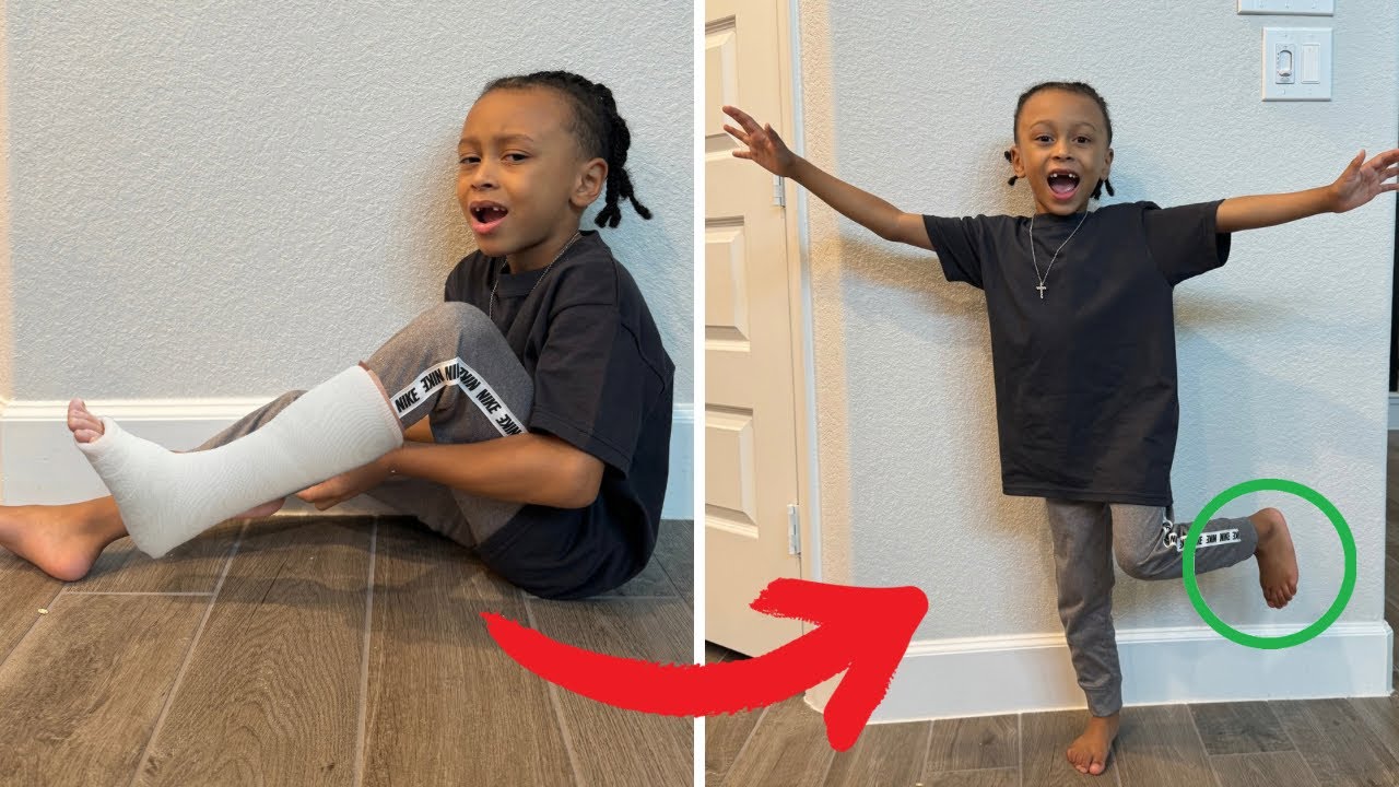 BIG BROTHER Gets Caught FAKING His BROKEN LEG, What Happens Is Shocking