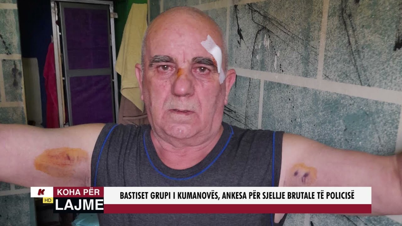 BASTISET GRUPI I KUMANOVËS, ANKESA PËR SJELLJE BRUTALE TË POLICISË